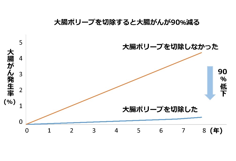 クリーンコロン（すべての大腸ポリープ切除）